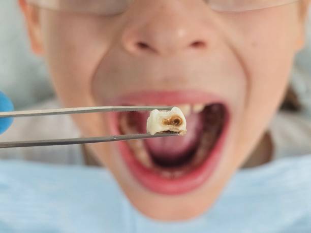 Best Weekend Emergency Dentist in Centerville, MN